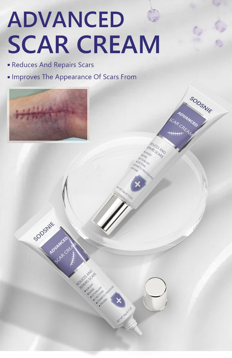 Advanced Scar Cream Remove Acne Spots